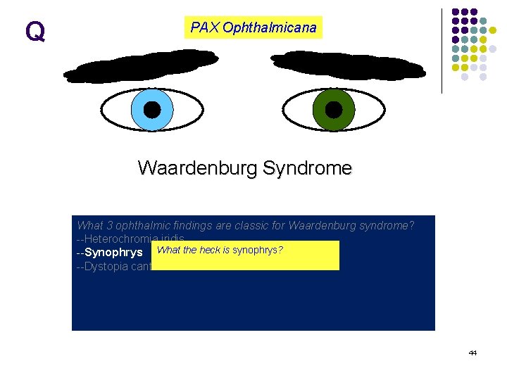 Q PAX Ophthalmicana Waardenburg Syndrome What 3 ophthalmic findings are classic for Waardenburg syndrome?