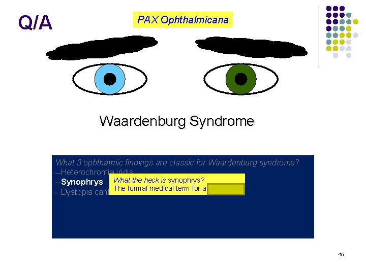 Q/A PAX Ophthalmicana Waardenburg Syndrome What 3 ophthalmic findings are classic for Waardenburg syndrome?