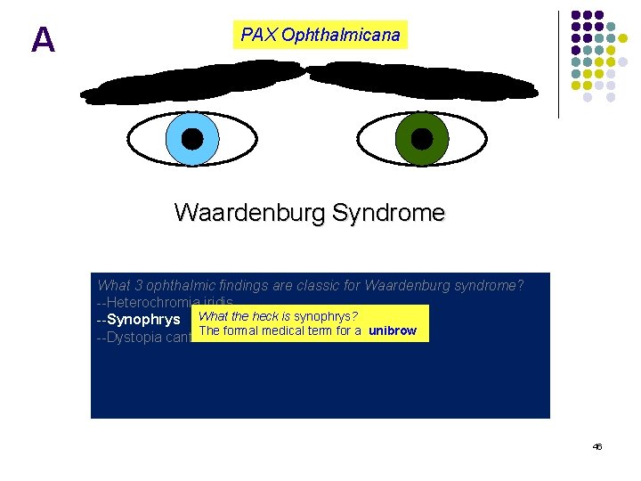 A PAX Ophthalmicana Waardenburg Syndrome What 3 ophthalmic findings are classic for Waardenburg syndrome?