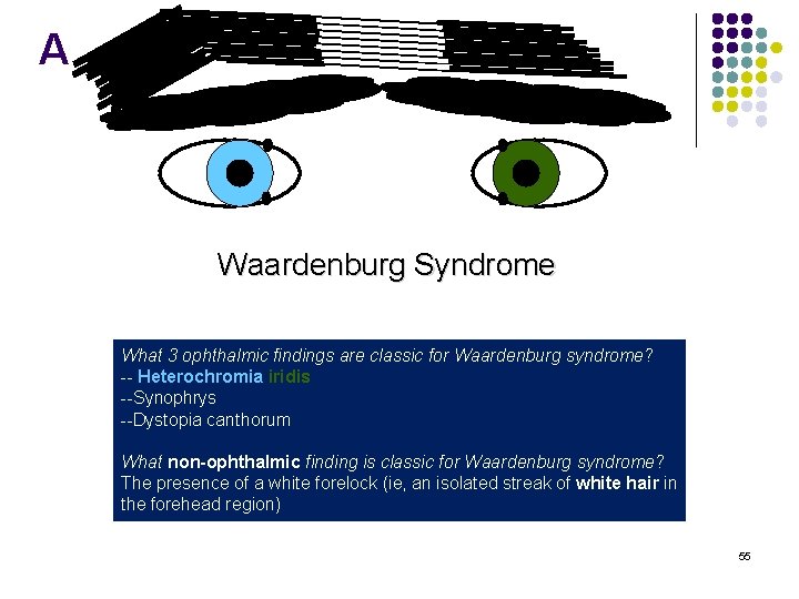 A Waardenburg Syndrome What 3 ophthalmic findings are classic for Waardenburg syndrome? -- Heterochromia