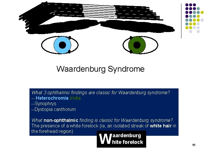 Waardenburg Syndrome What 3 ophthalmic findings are classic for Waardenburg syndrome? -- Heterochromia iridis