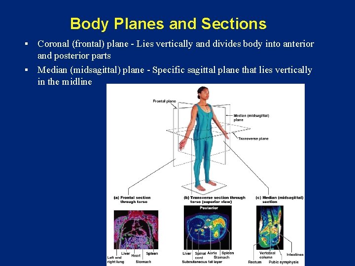 Body Planes and Sections Coronal (frontal) plane - Lies vertically and divides body into