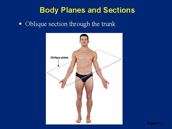 Body Planes and Sections § Oblique section through the trunk Figure 1. 6 