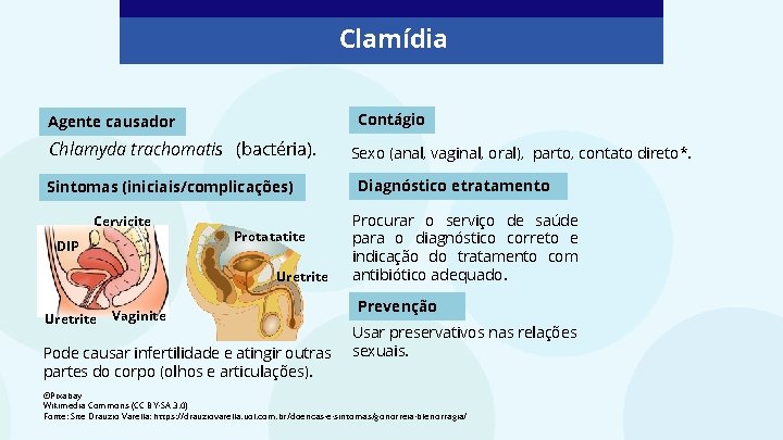 Clamídia Contágio Agente causador Chlamyda trachomatis (bactéria). Sintomas (iniciais/complicações) Cervicite DIP Protatatite Uretrite Vaginite Clamídia Contágio Agente causador Chlamyda trachomatis (bactéria). Sintomas (iniciais/complicações) Cervicite DIP Protatatite Uretrite Vaginite