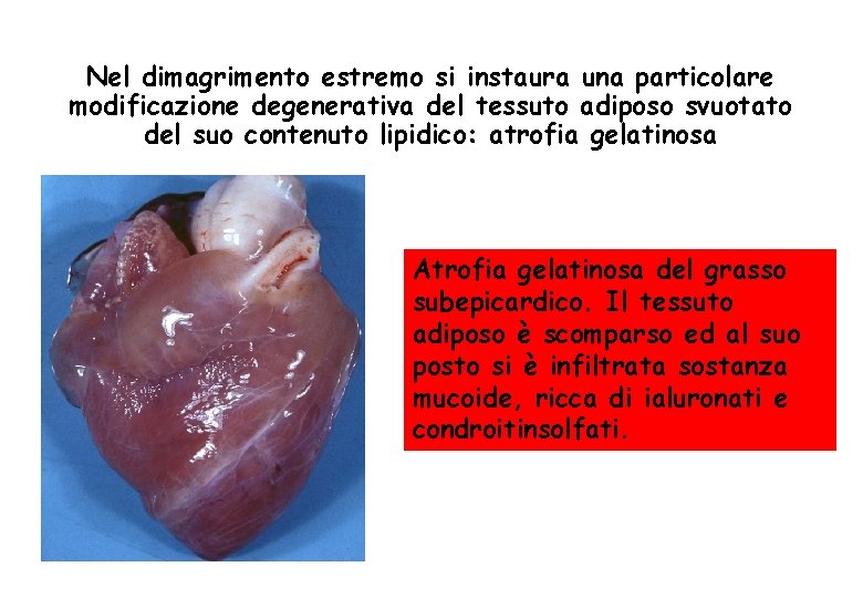 Nel dimagrimento estremo si instaura una particolare modificazione degenerativa del tessuto adiposo svuotato del