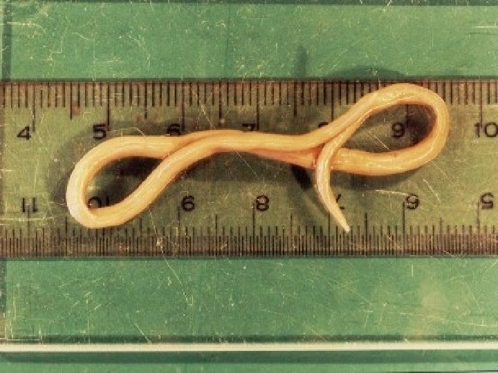 Vermes de corpo cilndrico FILO NEMATHELMINTHES CARACTERSTICAS GERAIS