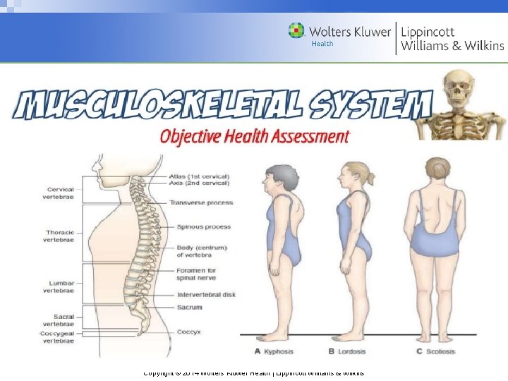 Copyright © 2014 Wolters Kluwer Health | Lippincott Williams & Wilkins 