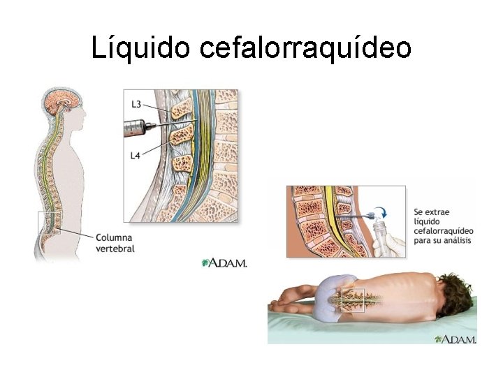 Líquido cefalorraquídeo 