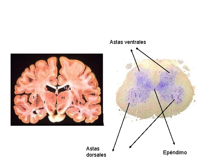 Astas ventrales Astas dorsales Epéndimo 