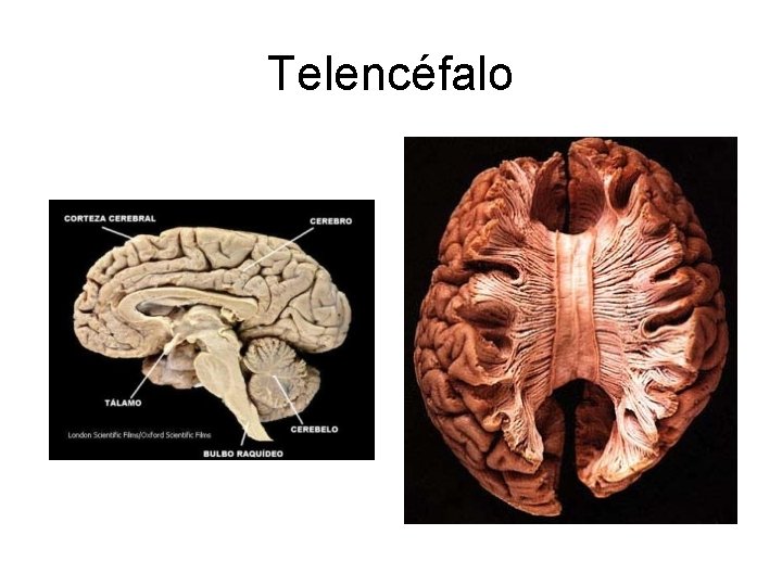 Telencéfalo 