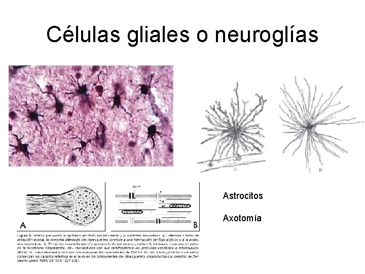 Células gliales o neuroglías Astrocitos Axotomía 