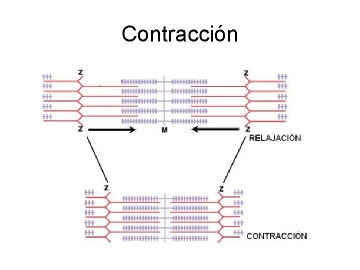 Contracción 