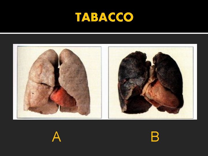 TABACCO A B 