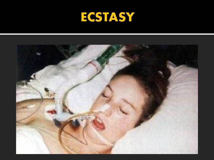 ECSTASY E’ una droga SINTETICA conosciuta anche come MDMA (Metilen. Diossi. Met. Amfetamina), viene
