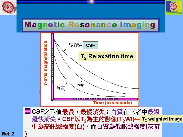 Y-axis magnetization Magnetic Resonance Imaging 腦脊液 CSF T 2 Relaxation time 白質 灰質 Time