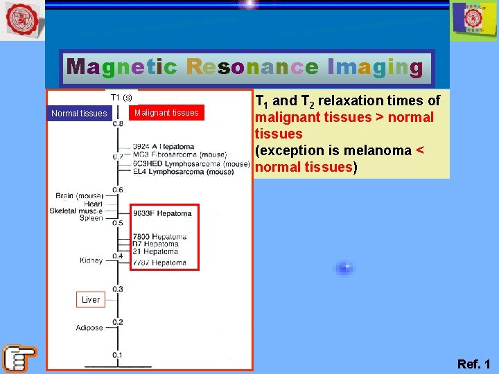 Magnetic Resonance Imaging T 1 (s) Normal tissues Malignant tissues T 1 and T