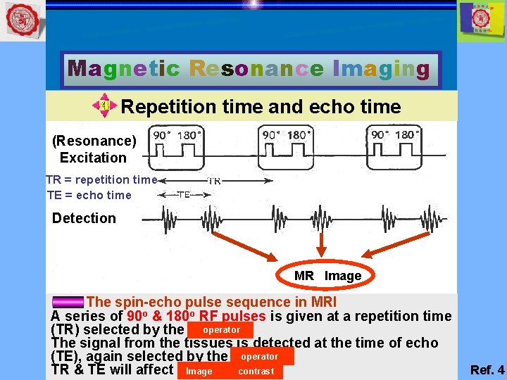 Magnetic Resonance Imaging Repetition time and echo time (Resonance) Excitation TR = repetition time