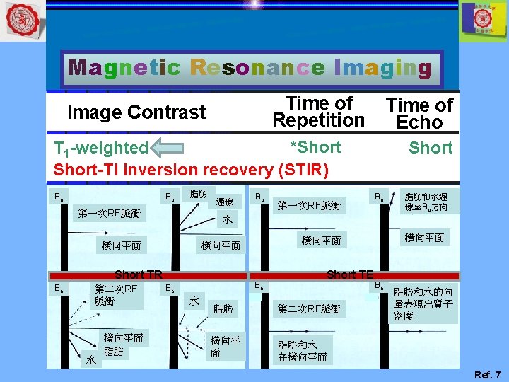 Magnetic Resonance Imaging Time of Repetition Image Contrast Time of Echo *Short T 1