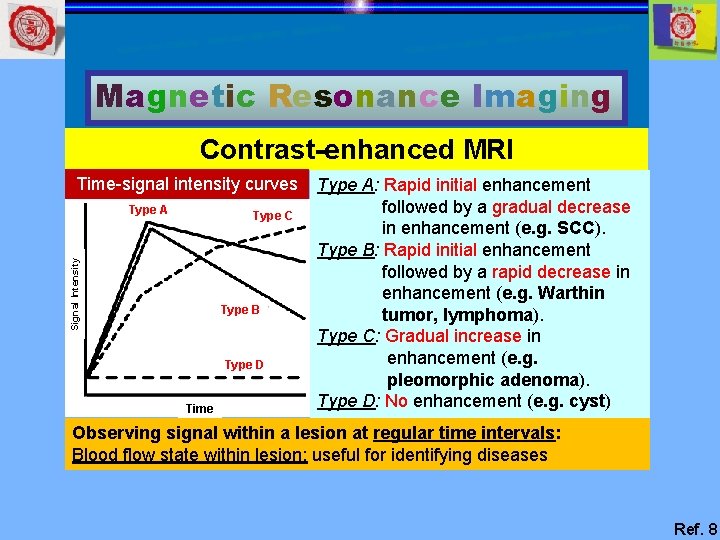 Magnetic Resonance Imaging Contrast-enhanced MRI Time-signal intensity curves Type A Signal Intensity Type C