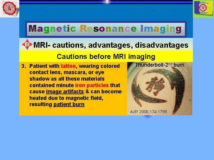 Magnetic Resonance Imaging MRI- cautions, advantages, disadvantages Cautions before MRI imaging 3. Patient with