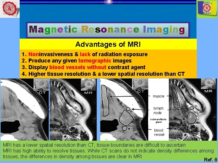 Magnetic Resonance Imaging Advantages of MRI 1. 2. 3. 4. Noninvasiveness & lack of
