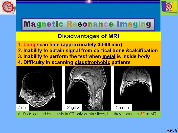 Magnetic Resonance Imaging Disadvantages of MRI 1. Long scan time (approximately 30 -60 min)