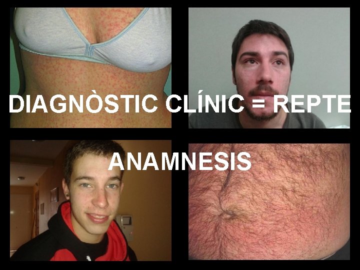 FOTO 1 DIAGNÒSTIC CLÍNIC = REPTE ANAMNESIS 