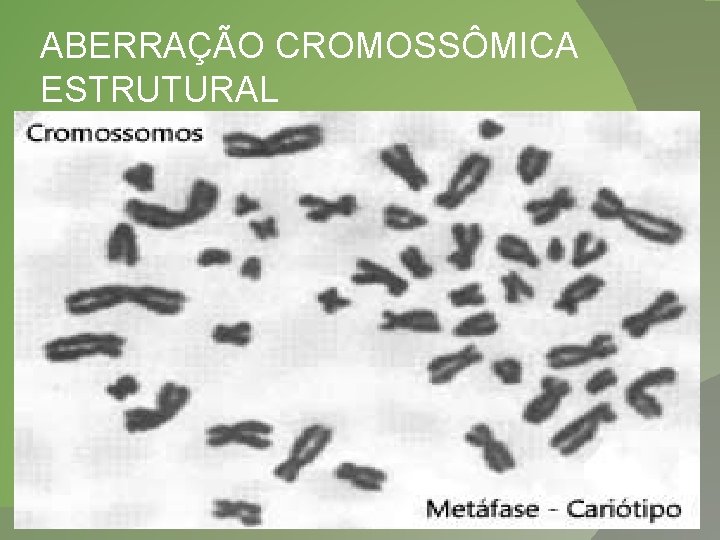 ABERRAÇÃO CROMOSSÔMICA ESTRUTURAL 