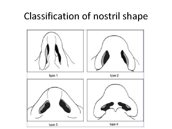 Classification of nostril shape 