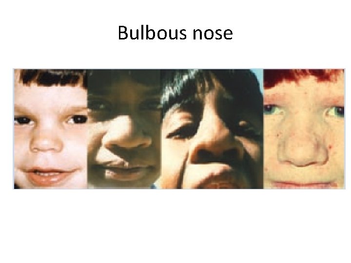 Bulbous nose 