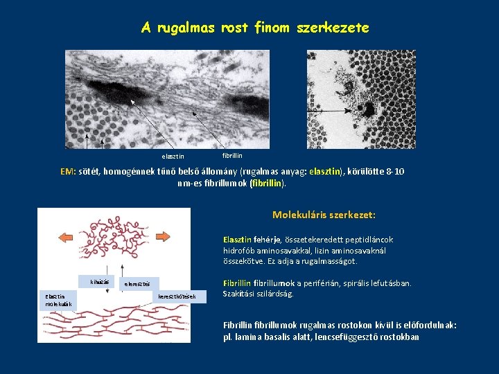 A rugalmas rost finom szerkezete elasztin fibrillin EM: sötét, homogénnek tűnő belső állomány (rugalmas