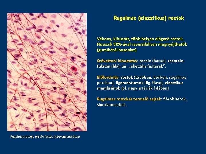 Rugalmas (elasztikus) rostok Vékony, kihúzott, több helyen elágazó rostok. Hosszuk 50%-ával reverzibilisen megnyújthatók (gumikötél