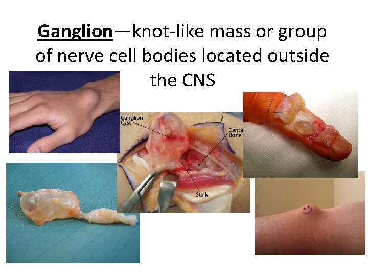 Ganglion—knot-like mass or group of nerve cell bodies located outside the CNS 