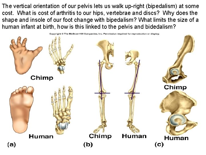 The vertical orientation of our pelvis lets us walk up-right (bipedalism) at some cost.