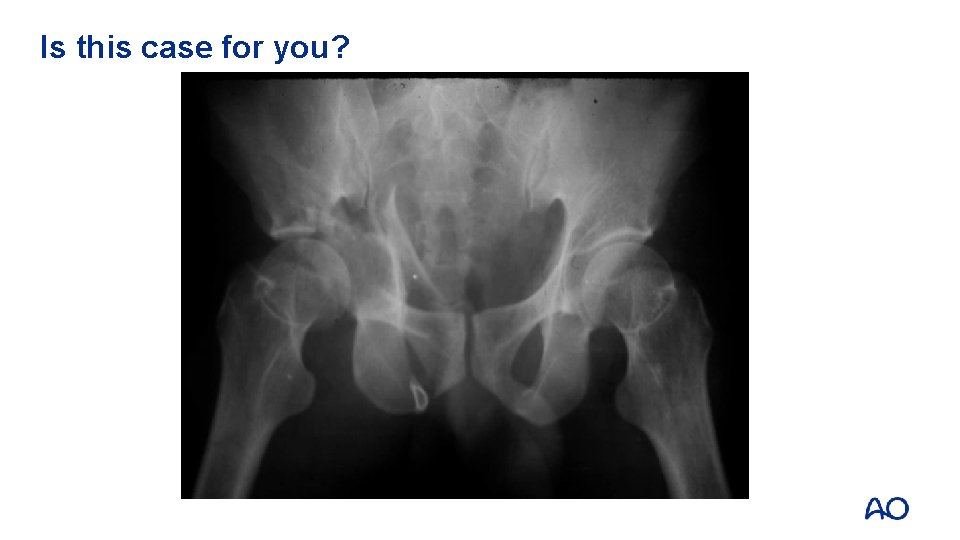Is this case for you? 
