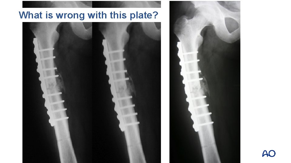 What is wrong with this plate? 
