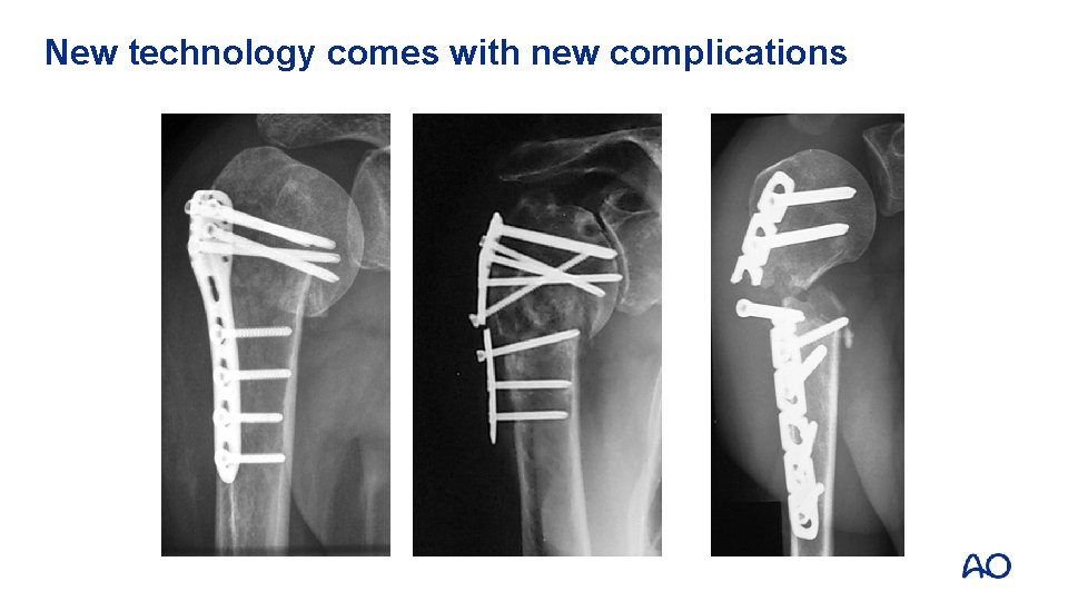 New technology comes with new complications 