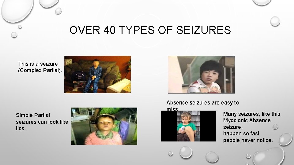 OVER 40 TYPES OF SEIZURES This is a seizure (Complex Partial). Simple Partial seizures OVER 40 TYPES OF SEIZURES This is a seizure (Complex Partial). Simple Partial seizures