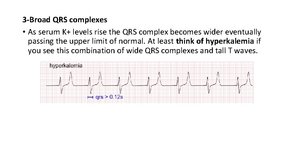 3 -Broad QRS complexes • As serum K+ levels rise the QRS complex becomes