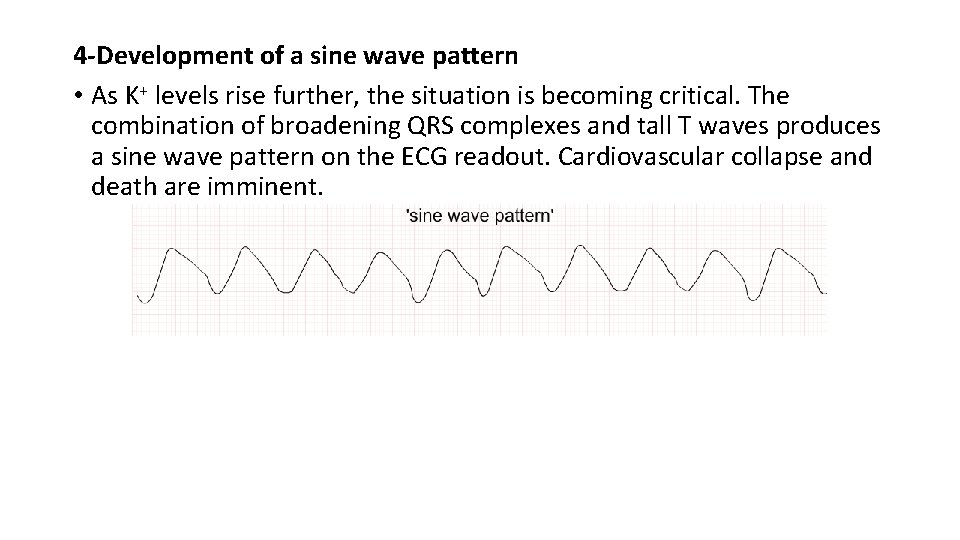 4 -Development of a sine wave pattern • As K+ levels rise further, the