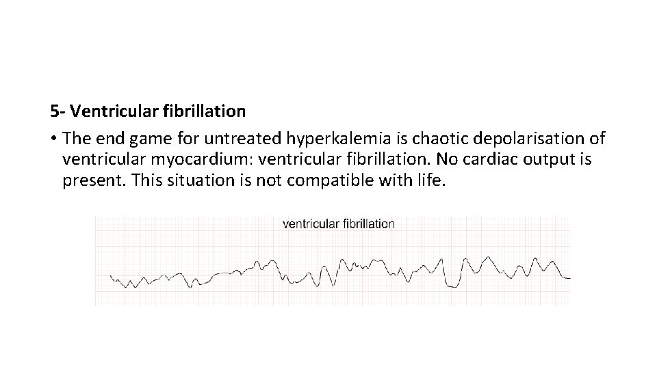 5 - Ventricular fibrillation • The end game for untreated hyperkalemia is chaotic depolarisation