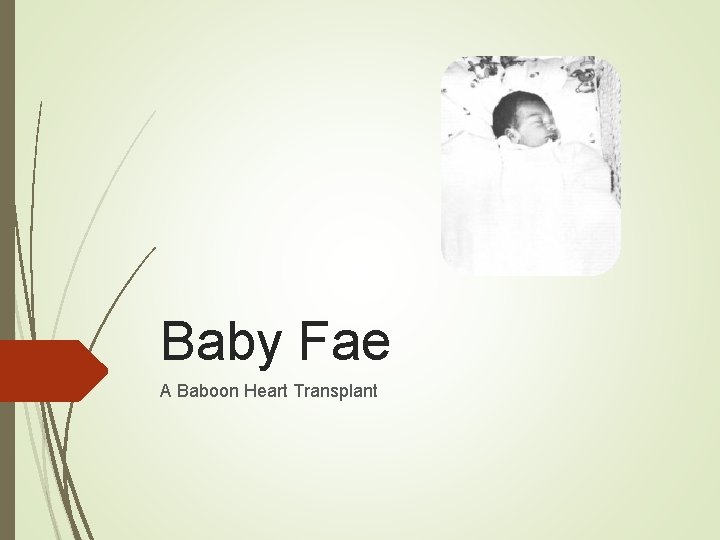 Baby Fae A Baboon Heart Transplant Baby Fae A Baboon Heart Transplant
