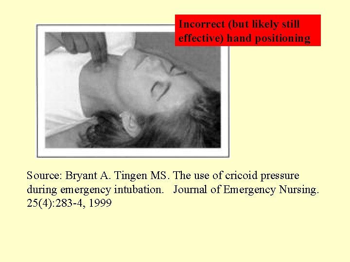 Incorrect (but likely still effective) hand positioning Source: Bryant A. Tingen MS. The use