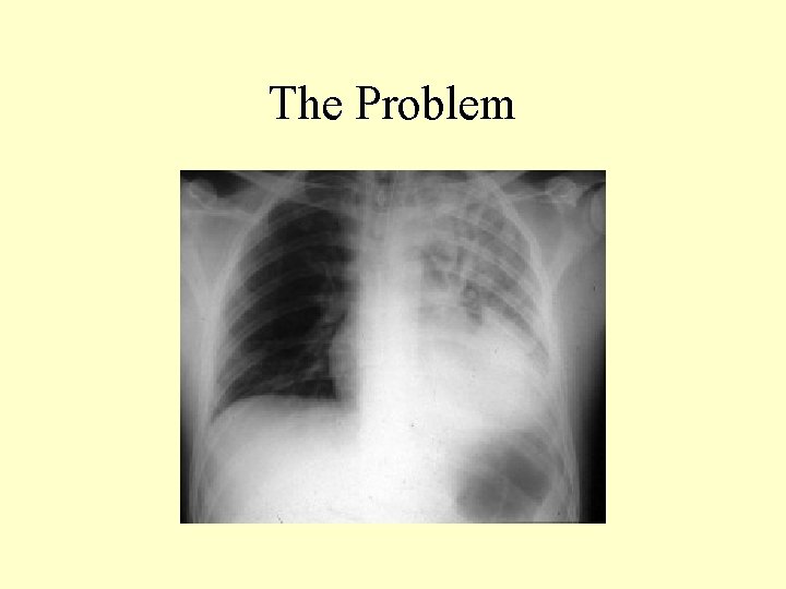 The Problem 