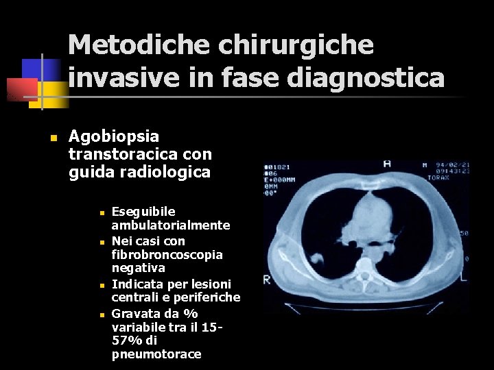 Metodiche chirurgiche invasive in fase diagnostica n Agobiopsia transtoracica con guida radiologica n n