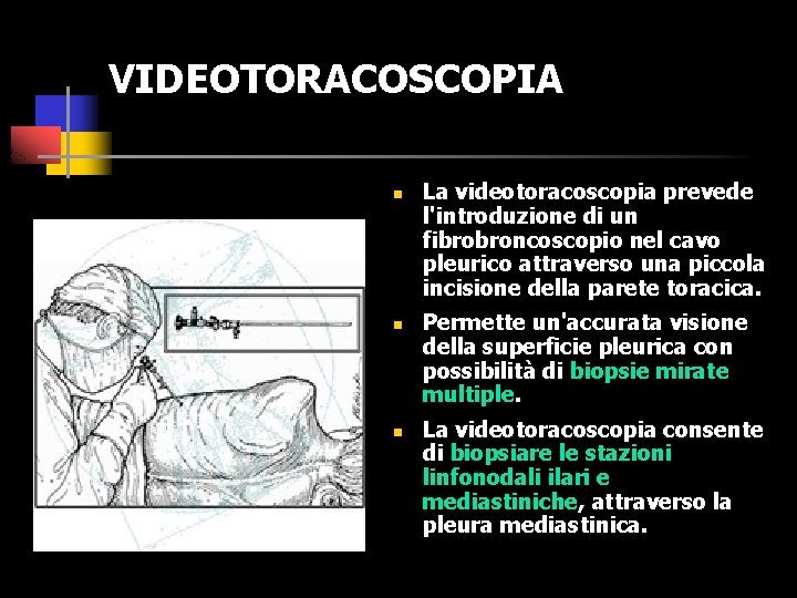 VIDEOTORACOSCOPIA n n n La videotoracoscopia prevede l'introduzione di un fibrobroncoscopio nel cavo pleurico