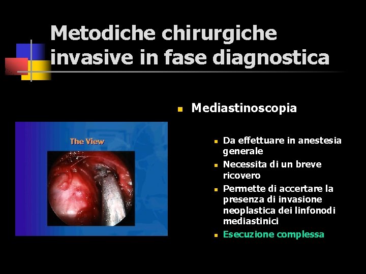 Metodiche chirurgiche invasive in fase diagnostica n Mediastinoscopia n n Da effettuare in anestesia