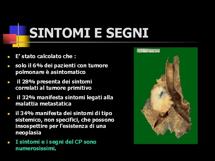 SINTOMI E SEGNI n n n E' stato calcolato che : solo il 6%