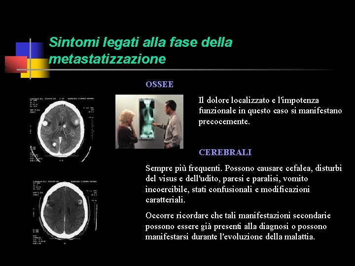 Sintomi legati alla fase della metastatizzazione OSSEE Il dolore localizzato e l'impotenza funzionale in