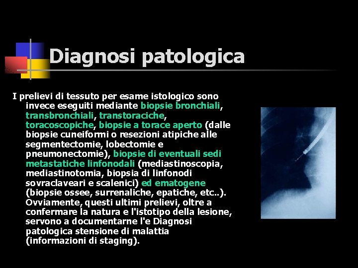 Diagnosi patologica I prelievi di tessuto per esame istologico sono invece eseguiti mediante biopsie